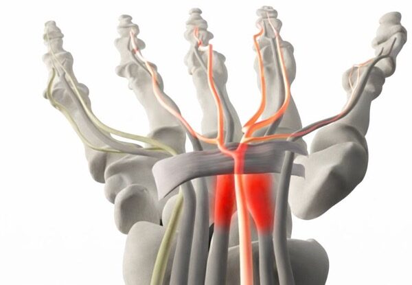 carpal graphic e1769907189362