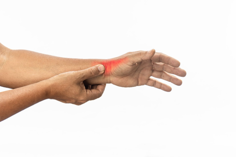 Radial Wrist Pain: Confirming De Quervain’s on Ultrasound 1 De Quervains