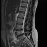 Your Scan Might Not Be the Problem 1 Scans and Pain 1