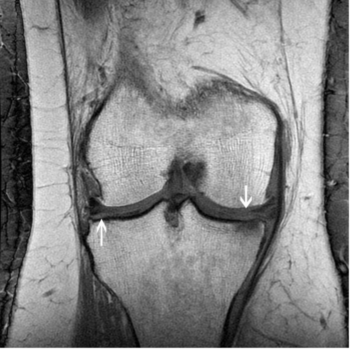 Scans and Pain 2